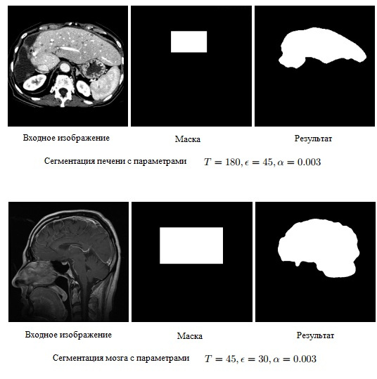 Бинарная сегментация изображений методом фиксации уровня (Level set method) - 7