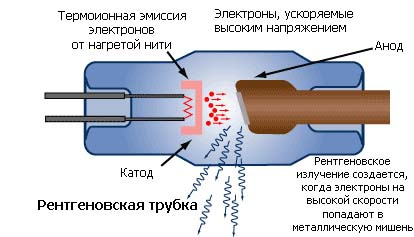 Чем нас досматривают? - 3