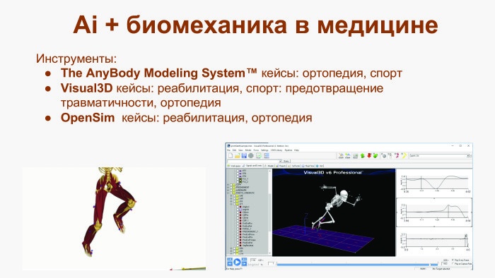 Биомеханика и искусственный интеллект в медицине. Лекция на YaC 2017 - 6