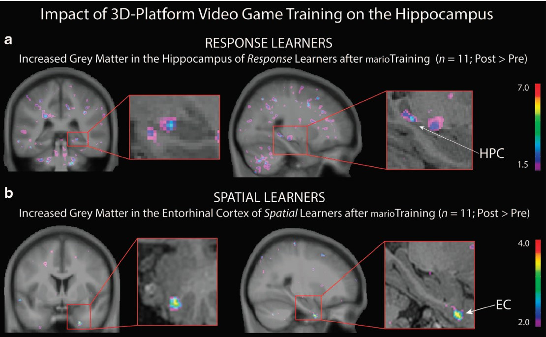 Компьютерные игры влияют на количество серого вещества в гиппокампе - 2