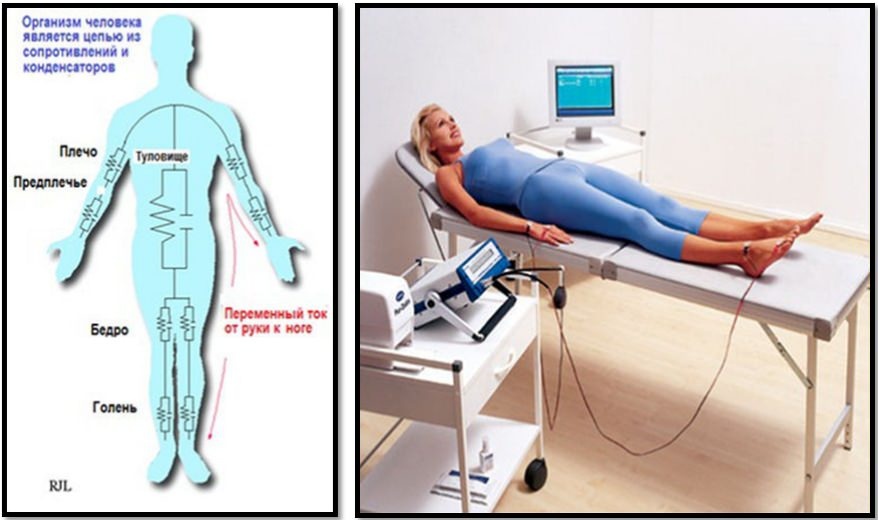 Весы-анализатор MGB Body fat scale — сравнительный «клинический» тест в ЦКБ РЖД - 2