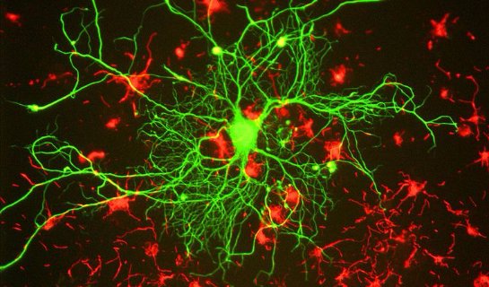 Ученые рассказали, что помогает нейронам развиваться Ученые рассказали, что помогает нейронам развиваться
