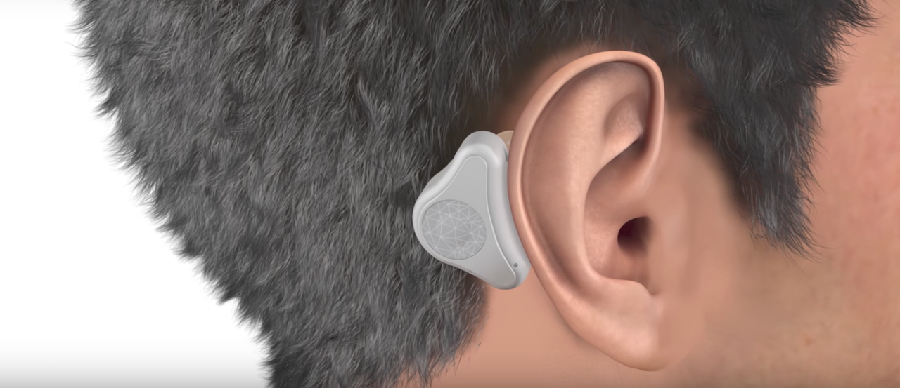 ADHEAR — еще один безопасный слуховой аппарат на базе костной проводимости звука - 3