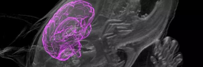 Органоиды мозга человека вживили в мозг живой крысы - 1