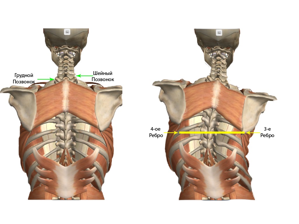 Остеохондроз и его деловые партнеры. История болезни - 10 image