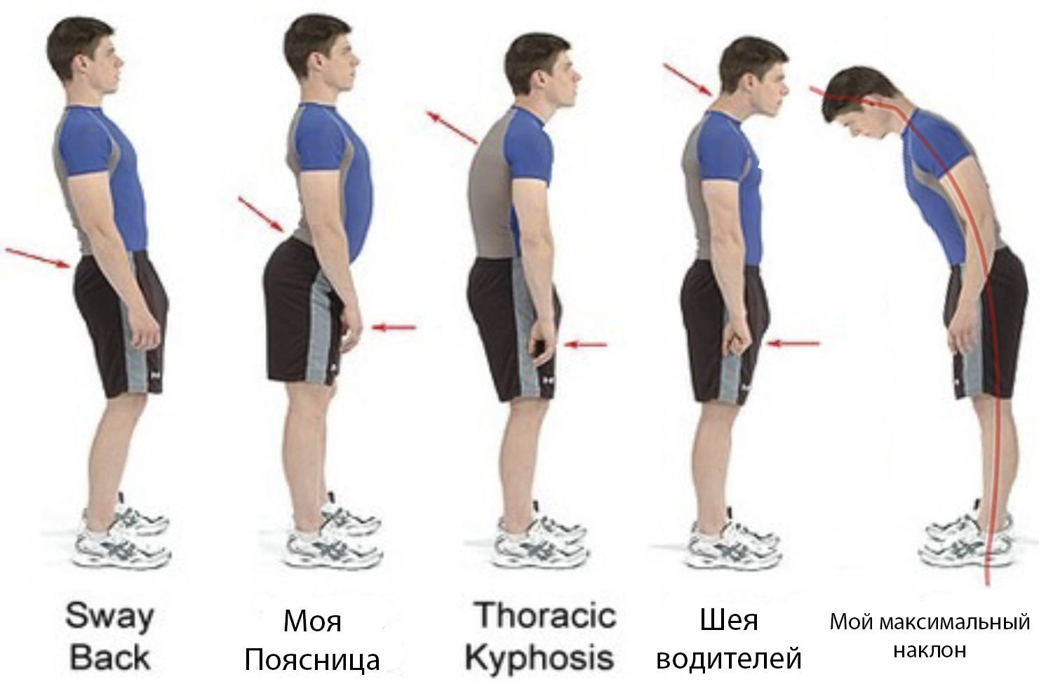 Остеохондроз и его деловые партнеры. История болезни - 2 image