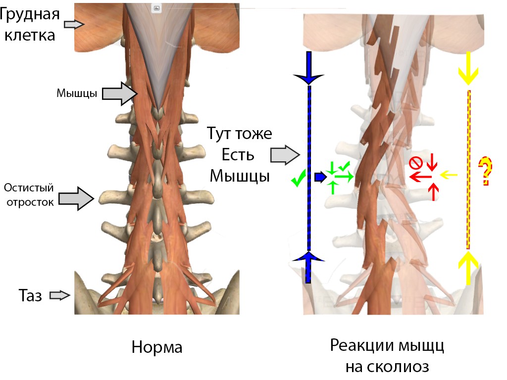 Остеохондроз и его деловые партнеры. История болезни - 7 image