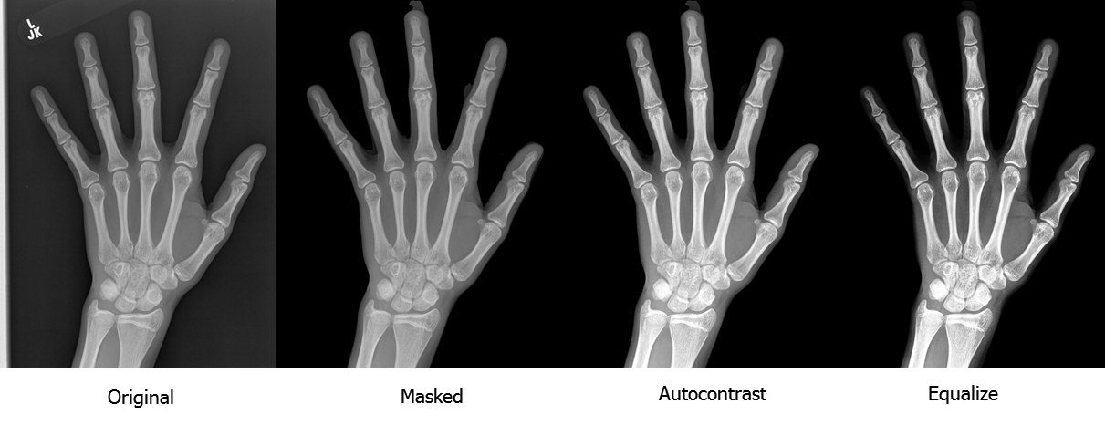 Pediatric Bone Age Challenge. Deep Learning и много, много костей - 4