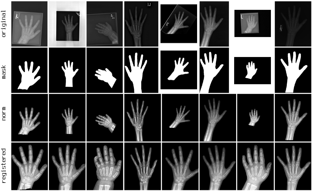 Pediatric Bone Age Challenge. Deep Learning и много, много костей - 7