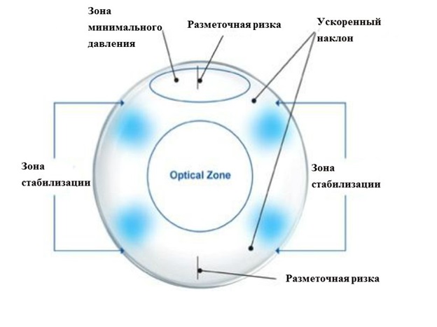 Контактные линзы при астигматизме (торические)