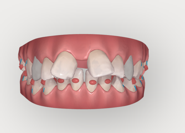Как оживить картинку в браузере. Многопроходный рендеринг в WebGL - 3 Как оживить картинку в браузере. Многопроходный рендеринг в WebGL - 3