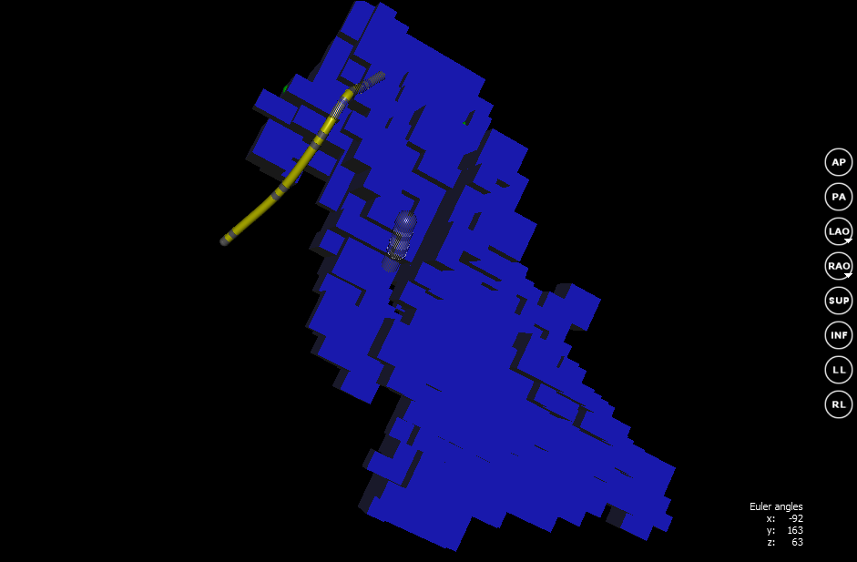 Квест по устранению аритмии сердца - 5 image