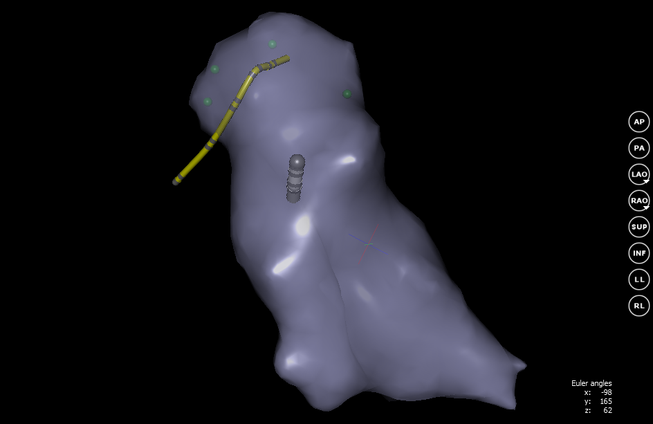 Квест по устранению аритмии сердца - 6 image