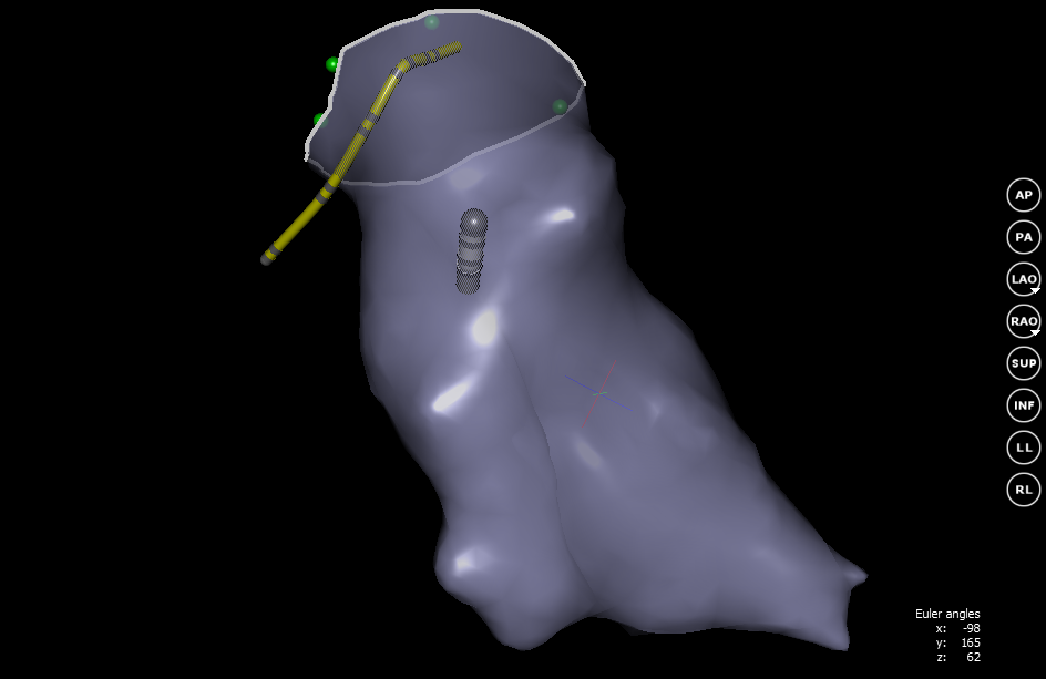 Квест по устранению аритмии сердца - 7 image