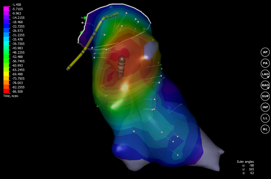 Квест по устранению аритмии сердца - 9 image