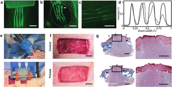Канадский 3D-биопринтер печатает заплатки для глубоких ран на коже - 3