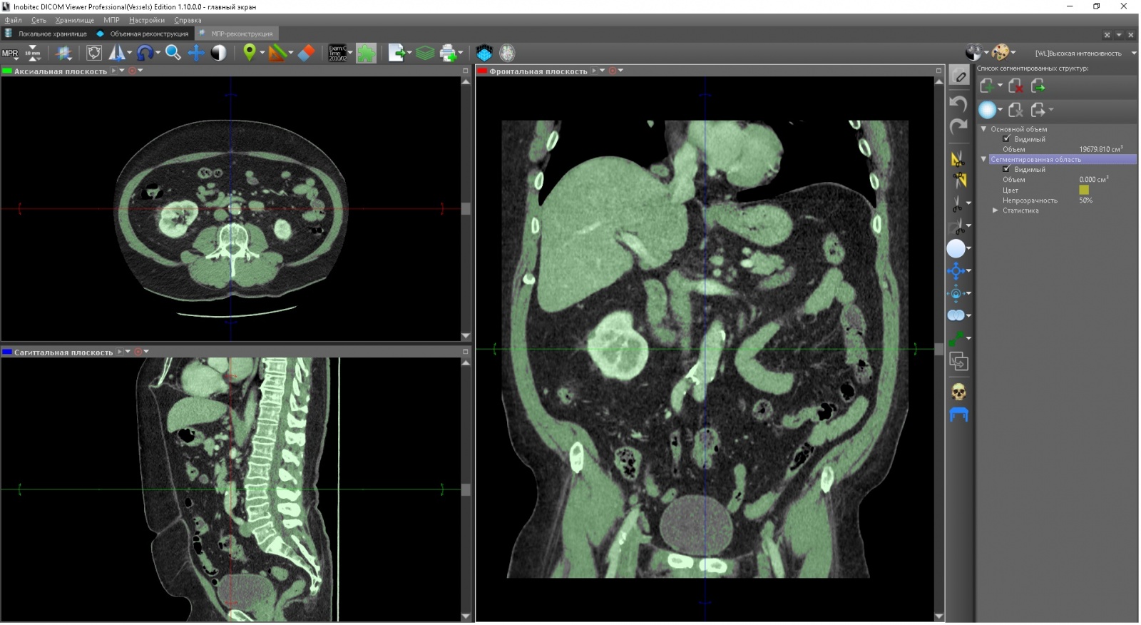 Inobitec dicom viewer. Автоматическая сегментация dicom. • inobitec dicom viewer (просмотрщик). Inobitec dicom viewer. Inobitec dicom viewer.