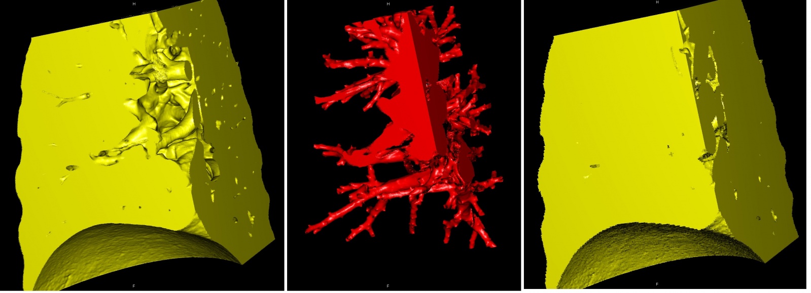 Сегментация томографических данных - 14 Сегментация томографических данных - 14