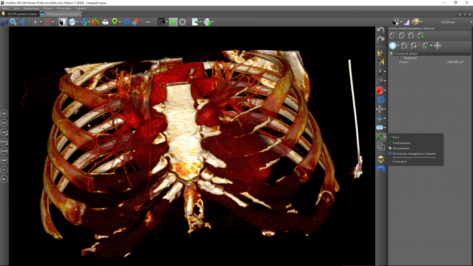 Автоматическая сегментация dicom. • inobitec dicom viewer (просмотрщик). Dicom сервер. Автоматическая сегментация dicom. • inobitec dicom viewer (просмотрщик).