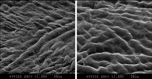Транс-ФРК: один из эталонов коррекции зрения - 4 image