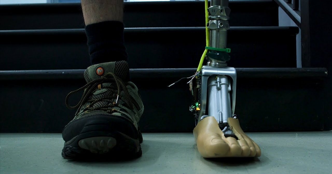Искусственные ноги теперь движутся как настоящие: чудо протезирования
