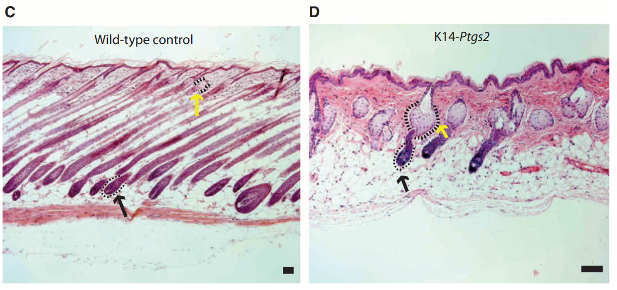 Облысение: Теория и практика лечения, ч.2 «Даже у простаты есть гланды, простагландины» - 5 Облысение: Теория и практика лечения, ч.2 «Даже у простаты есть гланды, простагландины» - 5