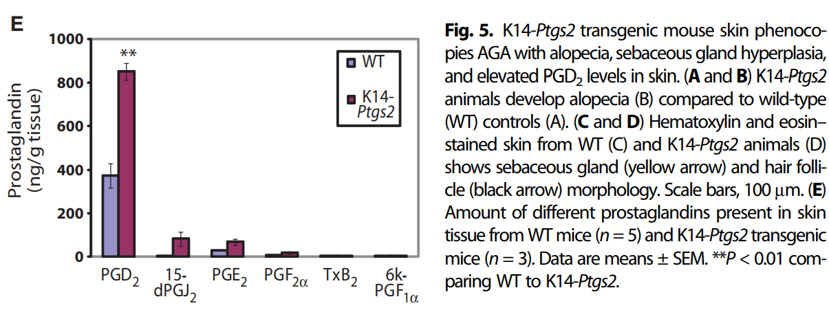 Облысение: Теория и практика лечения, ч.2 «Даже у простаты есть гланды, простагландины» - 6 Облысение: Теория и практика лечения, ч.2 «Даже у простаты есть гланды, простагландины» - 6