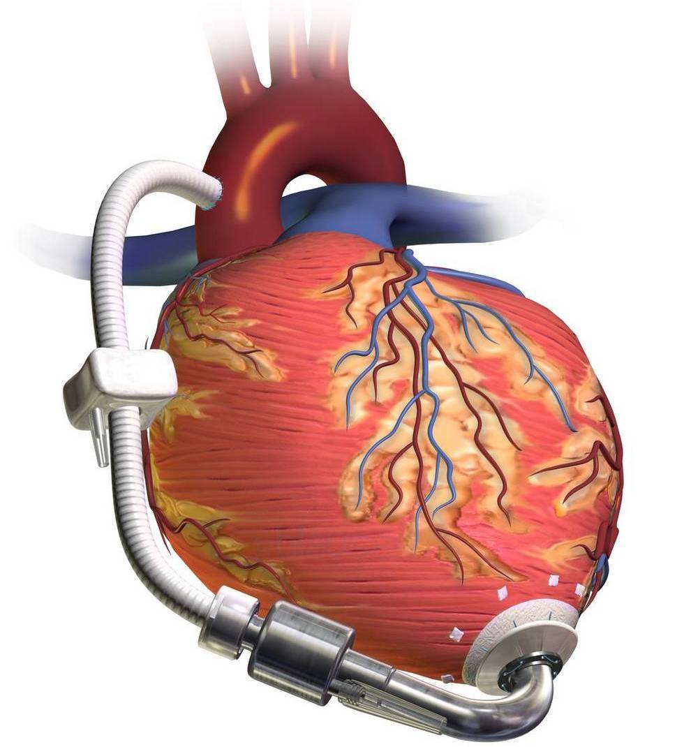 Что нам дала космонавтика? - 67 Что нам дала космонавтика? - 67