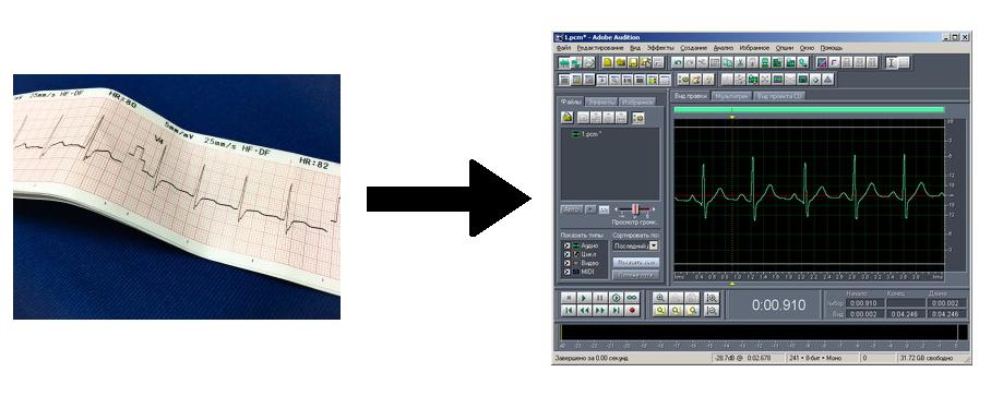 Как звучит сердцебиение: перевод бумажной кардиограммы в WAV-формат - 1