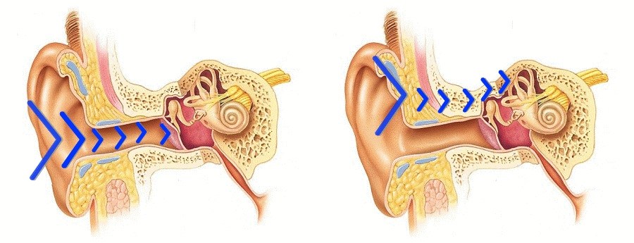 Кто «изобрел» костную проводимость, зачем она используется и насколько это безопасно для слуха - 1