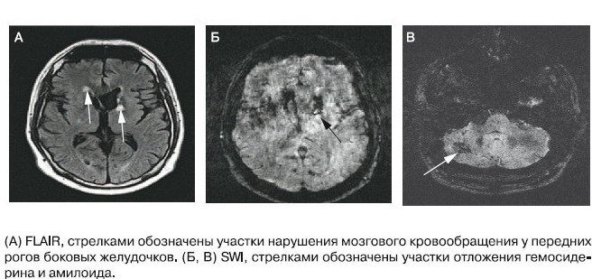 SENS-Диагностика. Биомаркеры белковых агрегатов - 5