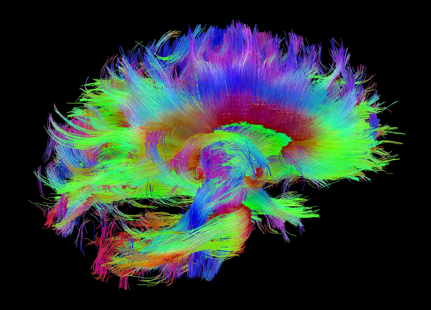 «Функциональный отпечаток» мозга может служить его идентификатором в течение всей жизни - 4
