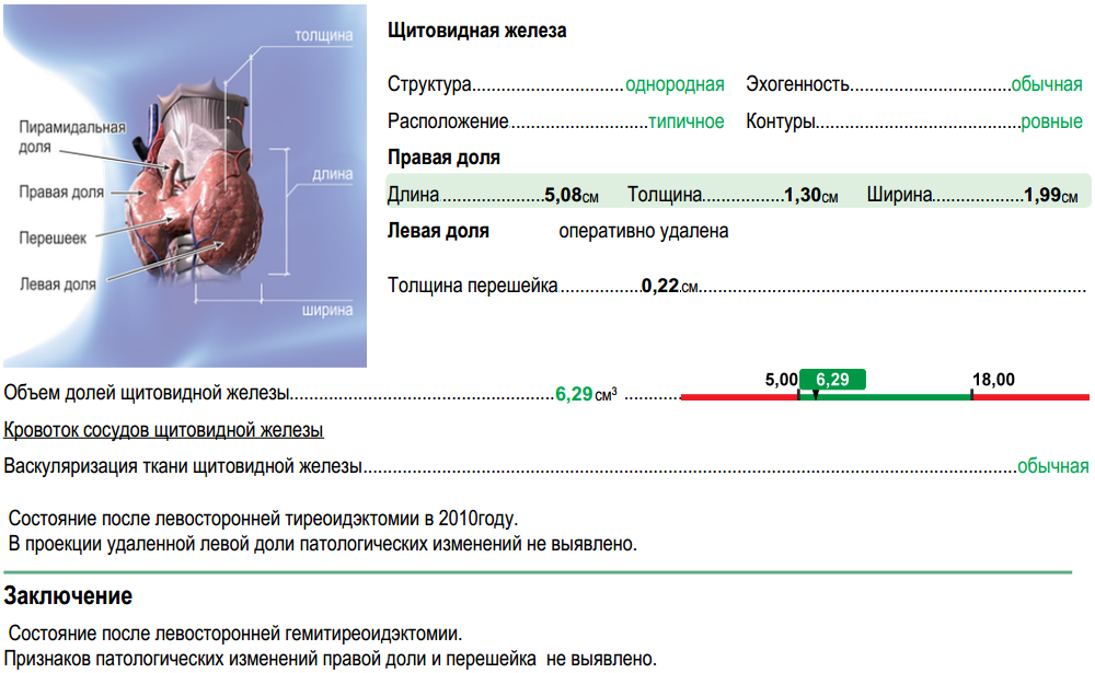 Изменение тканей щитовидной железы