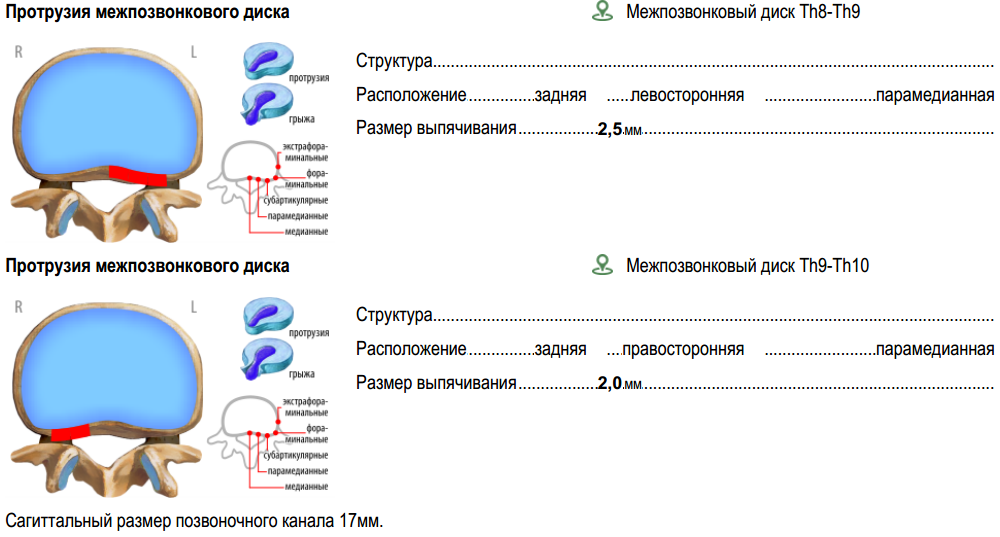 МИС. Вставки и удалённые органы - 6