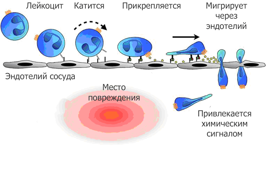 Нейровоспаление - 2