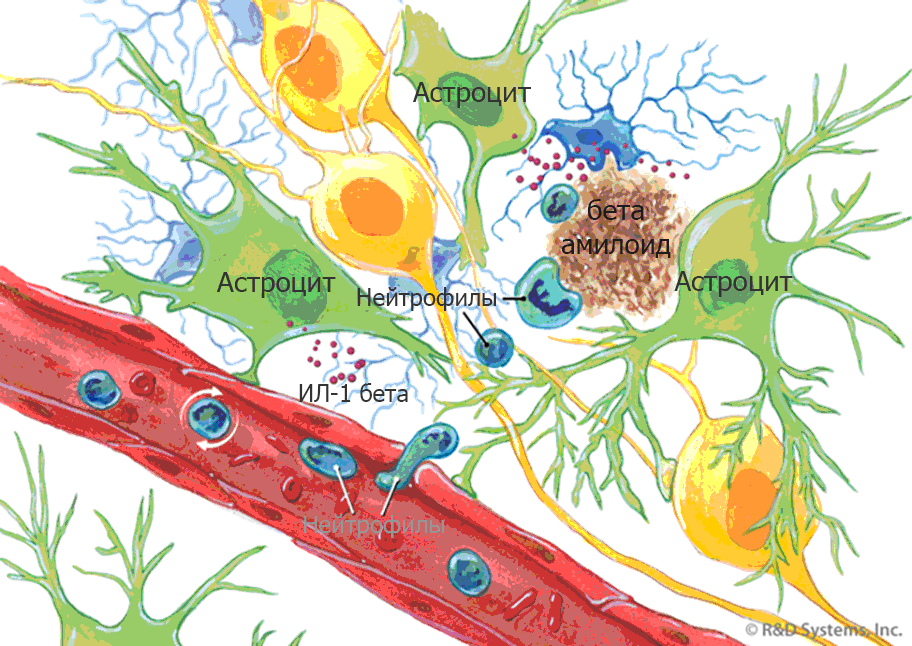 Нейровоспаление - 3