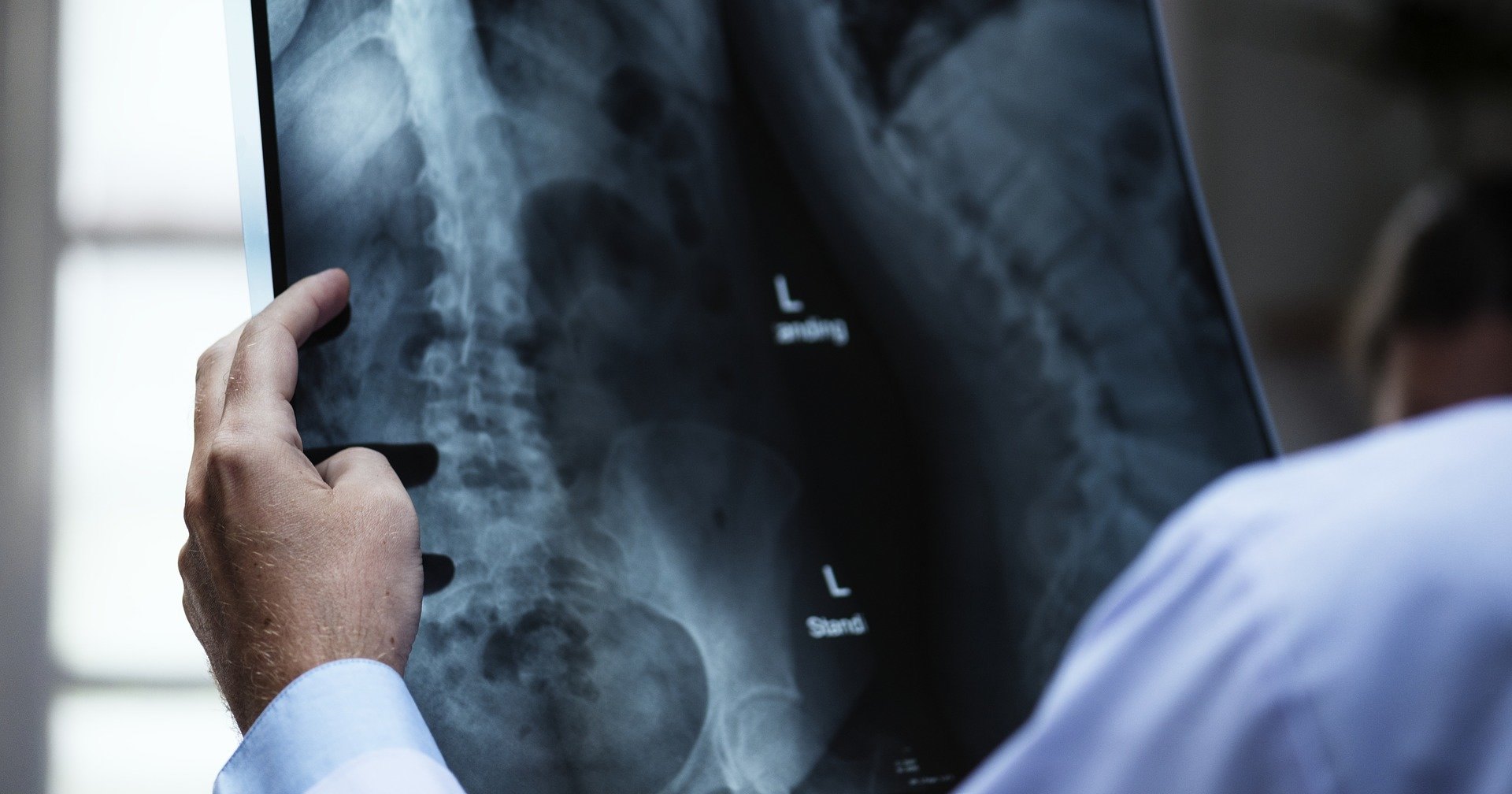 Искусственный интеллект обошел врачей в чтении рентгеновских снимков