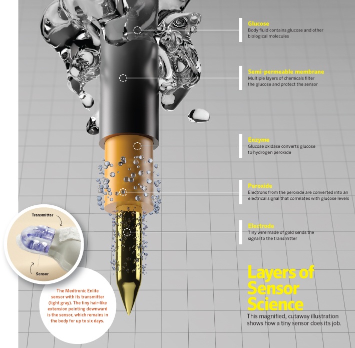 Почему так сложно непрерывно измерять уровень глюкозы? - 2