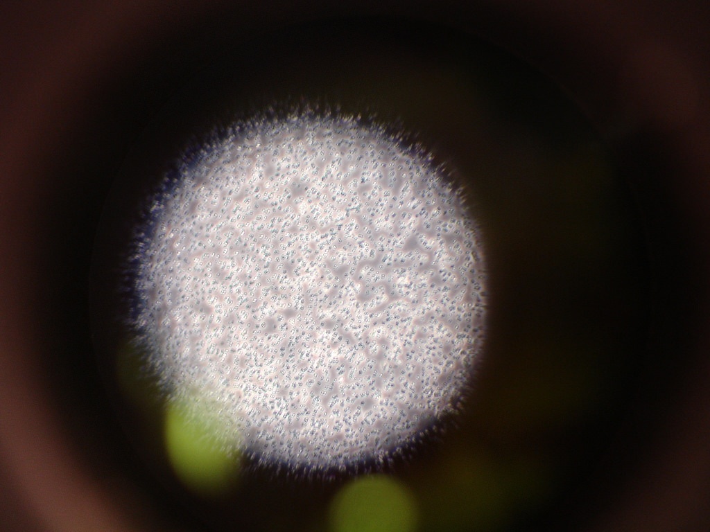 Новый ультразвуковой сенсор позволит «послушать» бактерии — как он устроен - 1 Новый ультразвуковой сенсор позволит «послушать» бактерии — как он устроен - 1