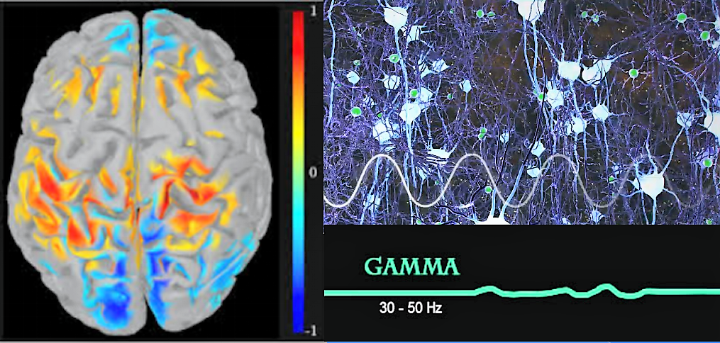 Стимуляция звуком и светом помогает при болезни Альцгеймера, пока у мышей, но результаты обнадеживают - 1