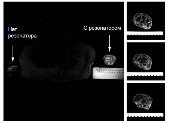 Разбираем магнитно-резонансный томограф II: Метаматериалы в МРТ - 15