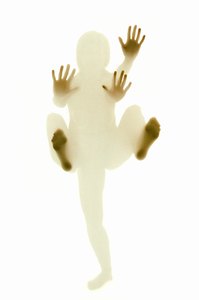 Генетические аномалии: люди, не чувствующие боли и видящие без глаз