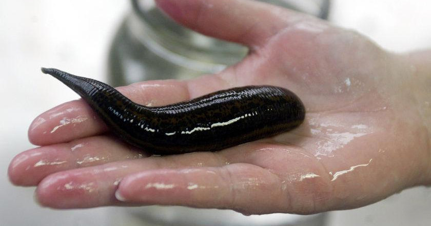 Врачи удалили двух живых пиявок из носа пациента Врачи удалили двух живых пиявок из носа пациента