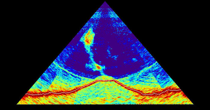 Обнаружено гигантское извержение подводного вулкана Обнаружено гигантское извержение подводного вулкана