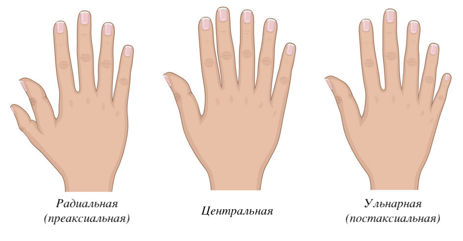 Не баг, а фича: исследование моторики и мозговой активности человека с полидактилией - 2 Не баг, а фича: исследование моторики и мозговой активности человека с полидактилией - 2