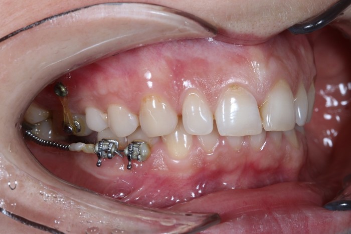 Зубы мудрости: Тянем-потянем - 10 image