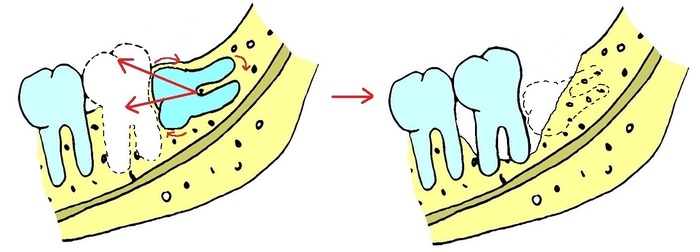 Зубы мудрости: Тянем-потянем - 4 image