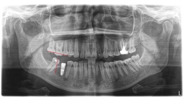 Зубы мудрости: Тянем-потянем - 9 image