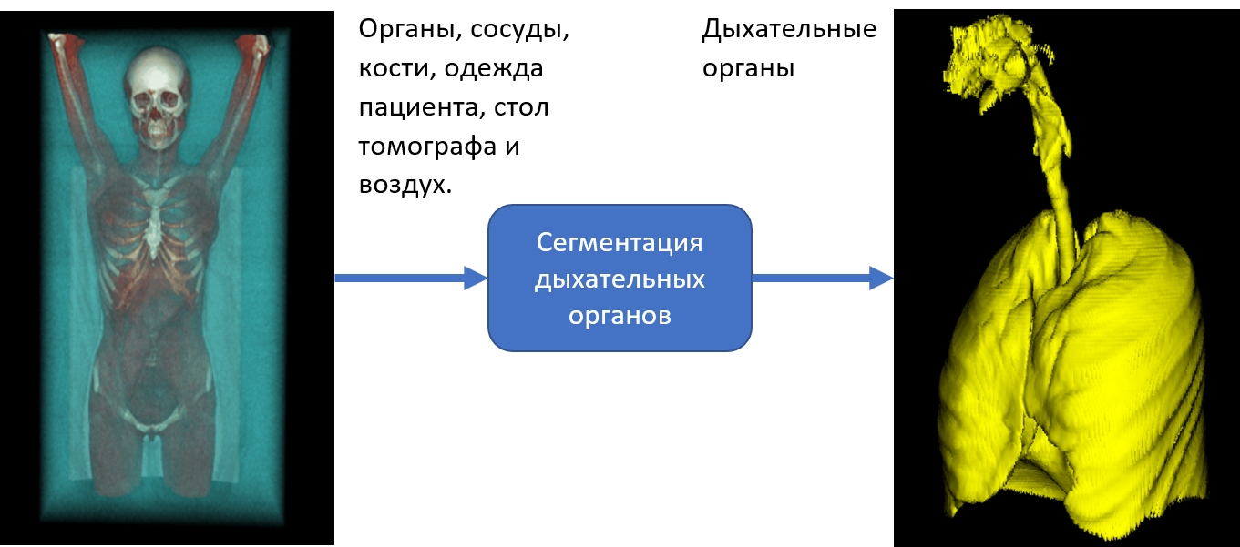 Автоматическая сегментация дыхательных органов - 24