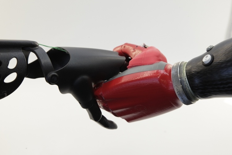 Протезы рук со встроенной телеметрией позволяют удалённо устранять проблемы Протезы рук со встроенной телеметрией позволяют удалённо устранять проблемы